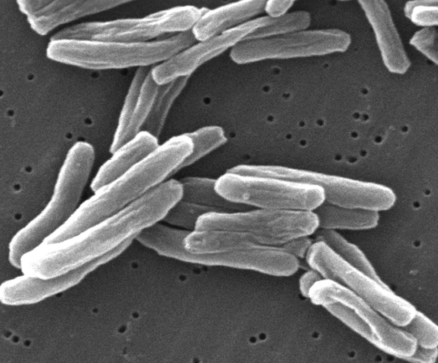 Tuberculosis bacteria, magnified about 15,500 times by a scanning electron microscope